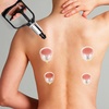 image:imageBeaupretty 5Pcs Manual Cupping Hand Pump Replacement Vacuum Suction Tool Lightweight Chinese Massage Accessory for Home Therapy 748X374X688In